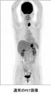 画像(168x320)・拡大画像(183x348)